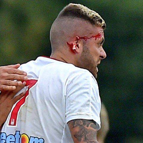 Menez orecchio ©Getty Images